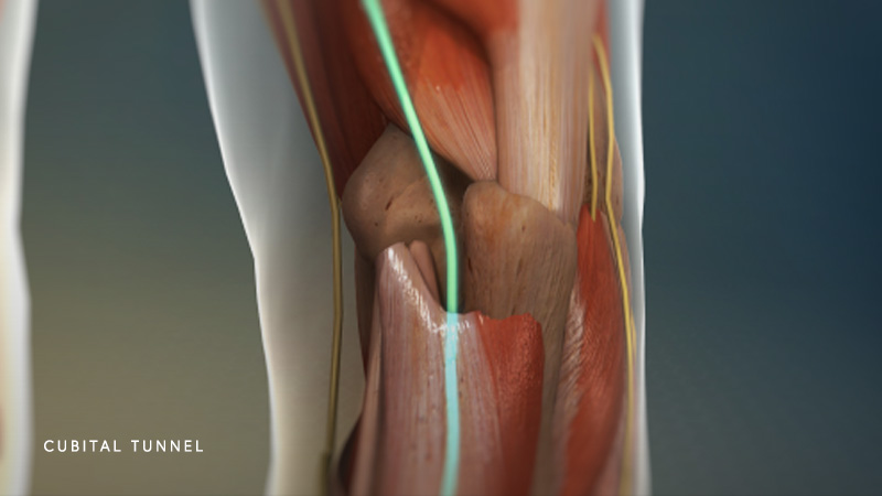 Cubital Tunnel Syndrome - Center for Orthopedic Specialists